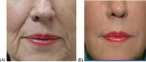 dermatologist ghaziabad